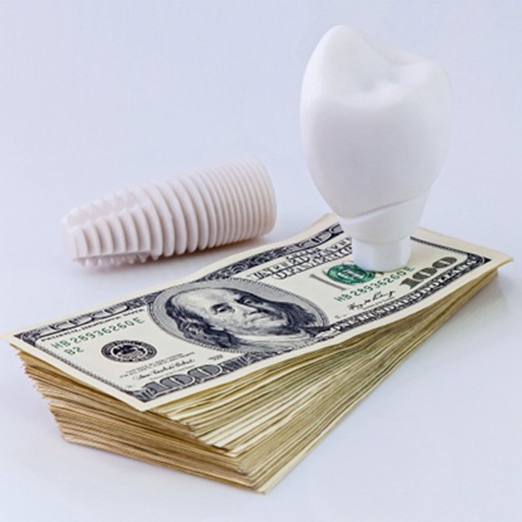 Dental implant on a stack of money