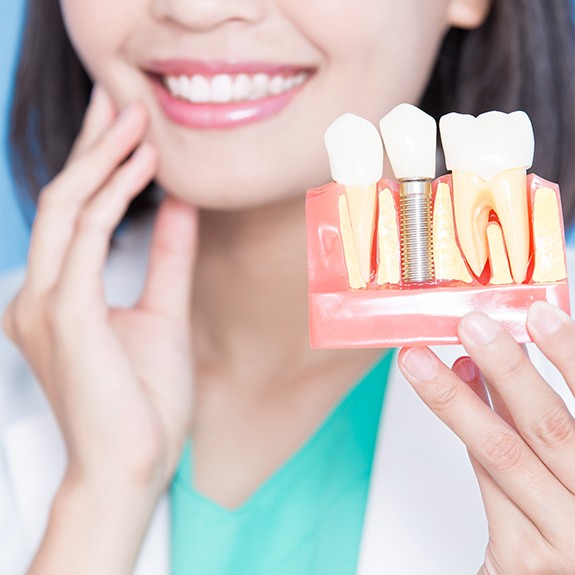 Dental team member holding dental implant model